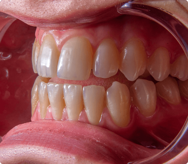 Dental examination showing preventive care with dental mirror