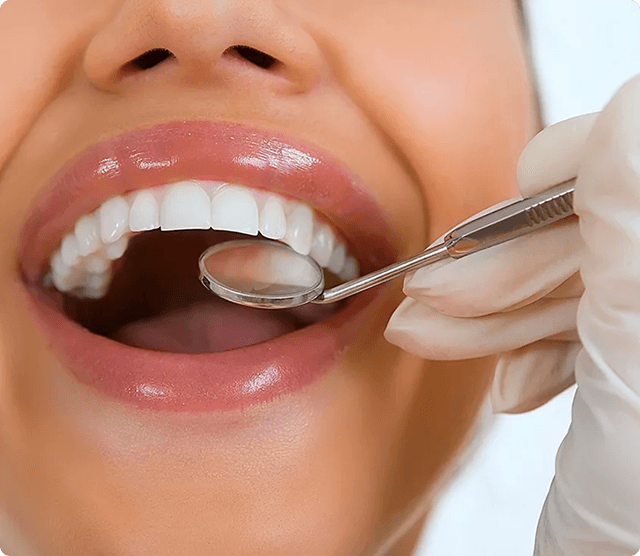 Dental examination showing preventive care with dental mirror