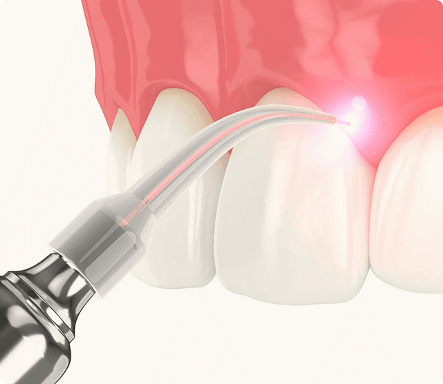 Dental examination showing preventive care with dental mirror