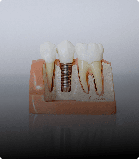 Restorative Dentistry